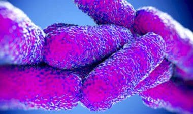 Busto Arsizio: ci mancava solo la legionella!