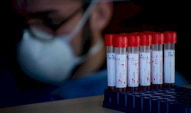 Coronavirus, dati dei principali comuni