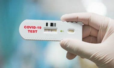 Malpensa: sdoganati 1 milione di test diagnostici per covid19