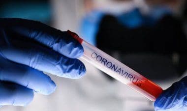 Coronavirus: contagi comuni della provincia di Varese, dati del 21 marzo