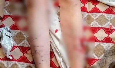 Siberia orientale, cani randagi aggrediscono estetista russa