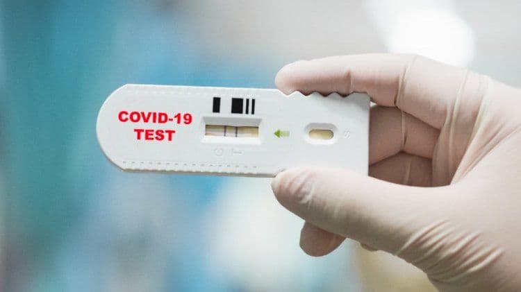 Malpensa: sdoganati 1 milione di test diagnostici per covid19