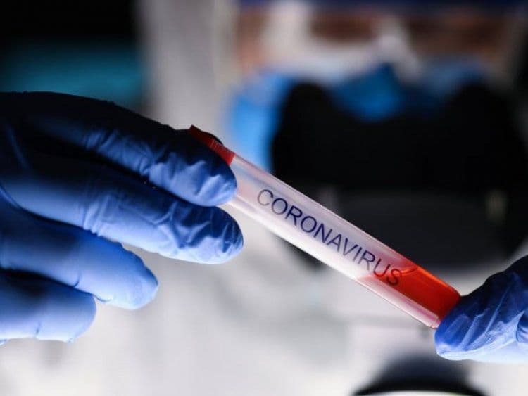Coronavirus: contagi comuni della provincia di Varese, dati del 21 marzo