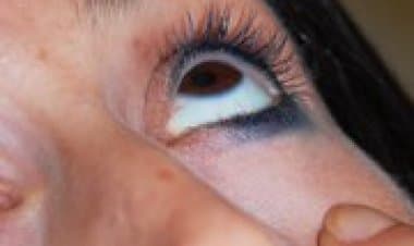 AIFA, divieto di utilizzo collirio GALAXIA. Ecco quale lotto è stato ritirato